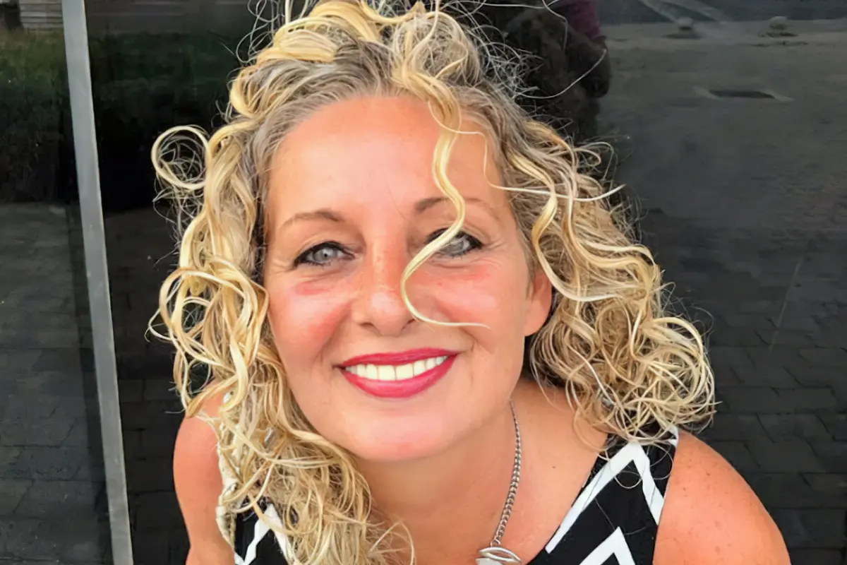 Hollywood smile – di che cosa si tratta e come lo otteniamo?