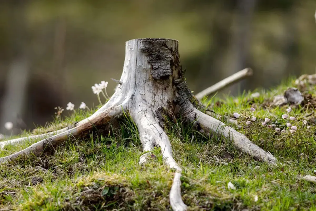 La paradontosi deve essere considerata grave