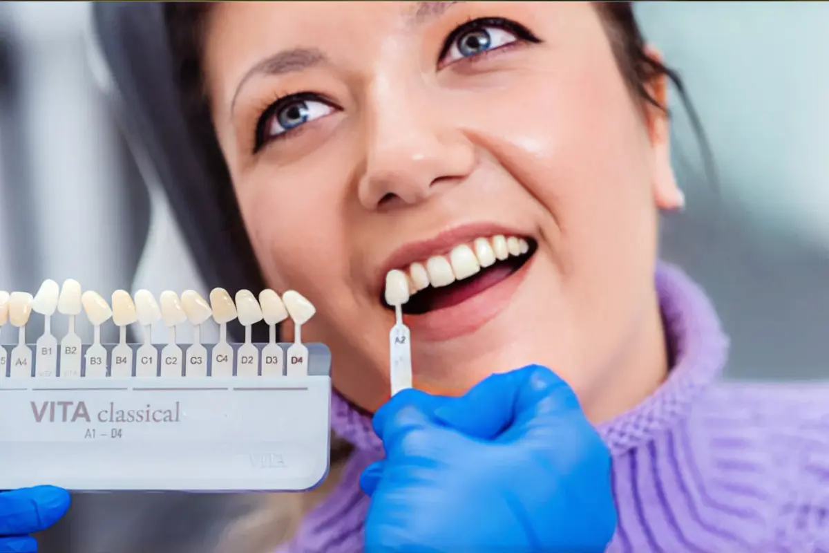 Un impianto dentale avvitato – quanto può costare?