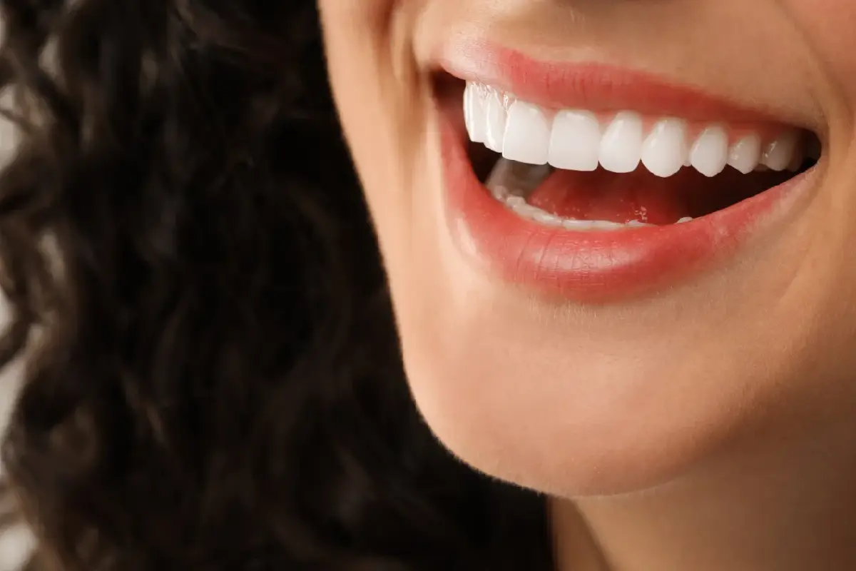 Tutto quello che c’è da sapere sulle corone dentali